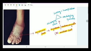 Subcutaneous Deep Mycoses  Microbiology  Image based discussion [upl. by Olegnaleahcim629]