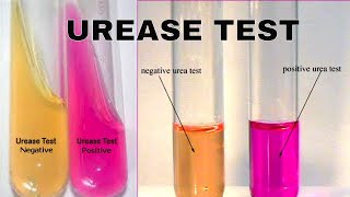 Urea Hydrolysis Urease Test [upl. by Enomaj484]