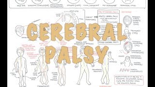 Cerebral Palsy  DETAILED Overview [upl. by Arnold]