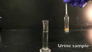 Using a Urinometer [upl. by Ian]