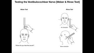 Interpreting the WeberRinne Tests EXPLAINED [upl. by Aiciles]