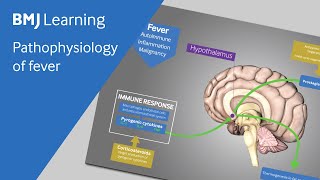 Pathophysiology of fever explained [upl. by Barncard791]