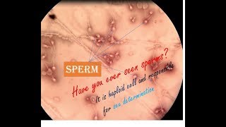 Live Sperm  Sperms under microscope haploid cell  sperm morphology [upl. by Tillfourd]