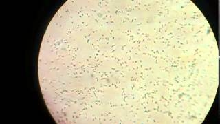 Sperm cells in microscope [upl. by Maupin]