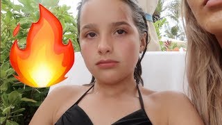 We All Got Burned 🔥 WK 3433  Bratayley [upl. by Gereld]