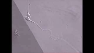 Sperm swimming in microscope field [upl. by Zola]