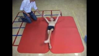 Dyskinetic cerebral palsy case 3 [upl. by Gnivri]