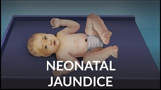 Neonatal Jaundice by L Veit  OPENPediatrics [upl. by Hill]