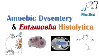 Amebiasis Amoebic Dysentery  Entamoeba histolytica Pathogenesis Signs amp Symptoms Treatment [upl. by Gravante473]