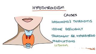 Hypothyroidism and Hashimotos Thyroiditis Visual Explanation for Students [upl. by Okiron399]