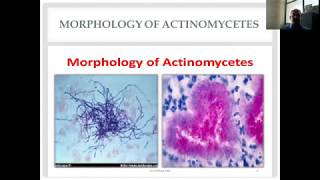 Actinomycetes and Nocardia Diverse Group of Gram Positive Bacilli [upl. by Nommad]