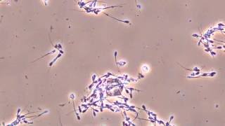 Moving pig sperm observed by biological [upl. by Florry]